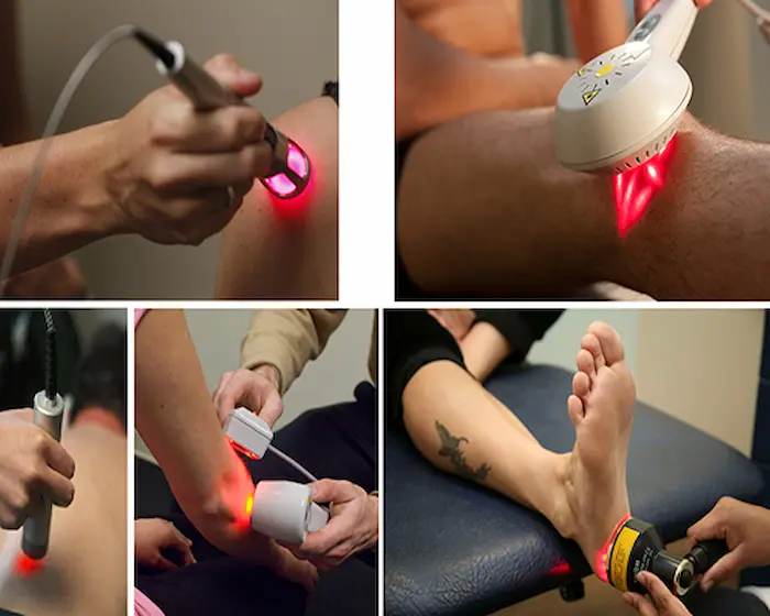 لیزر درمانی تمام نقاط بدن از جمله کتف، پا و بازو 48564