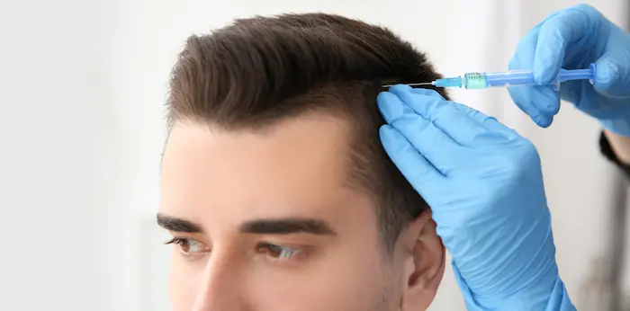 مزوتراپی مو، روش درمانی برای ریزش موی سر برای یک مرد 263156